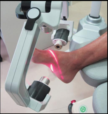 Laser de linha vermelha para al&iacute;vio da dor 