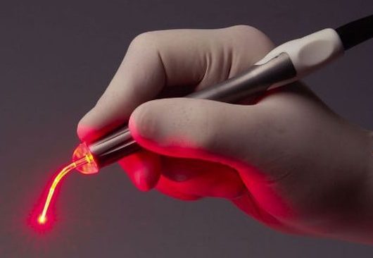 Aplicações médicas de 375-980nm semicondutores Lasers acoplados a fibras e seus princípios de trabalho